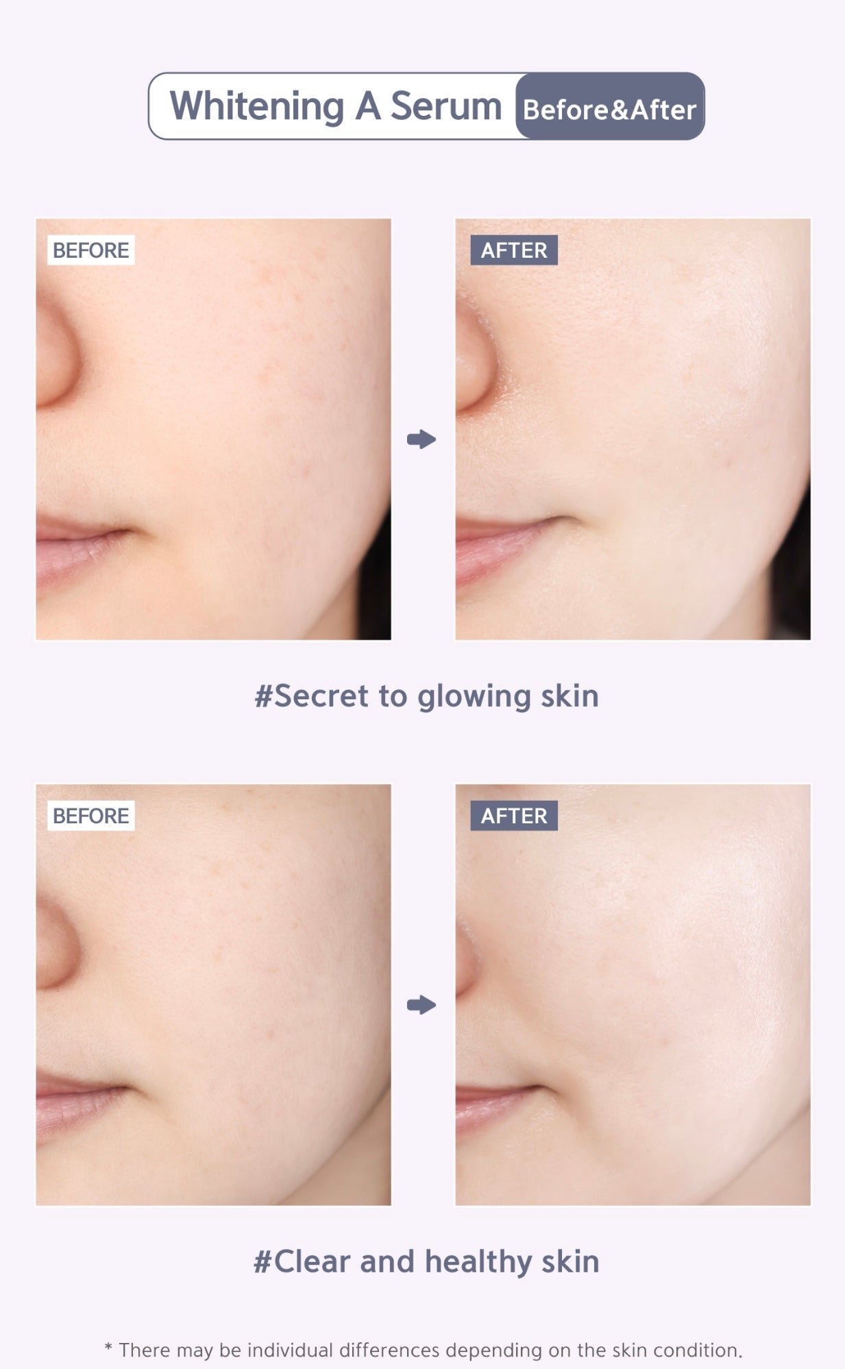 Whitening A Serum 50ml